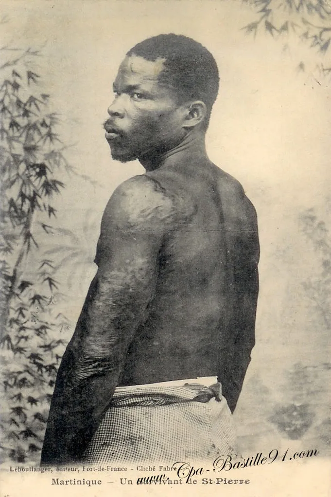 Cyparis célèbre suvivant de la Montagne Pelée